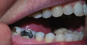 Chinese Youth Are Ditching Skin Tattoos for Tooth Tattoos